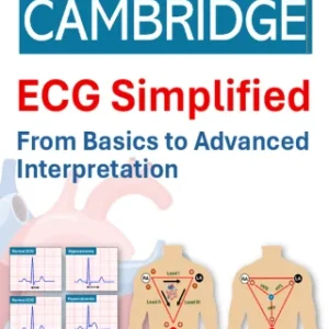 Test - Cambridge ECG Simplified