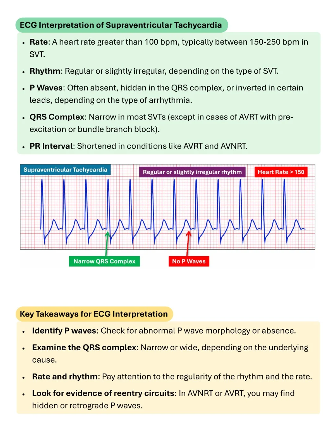 Cambridge ECG Simplified Made Easy Sample images (10)