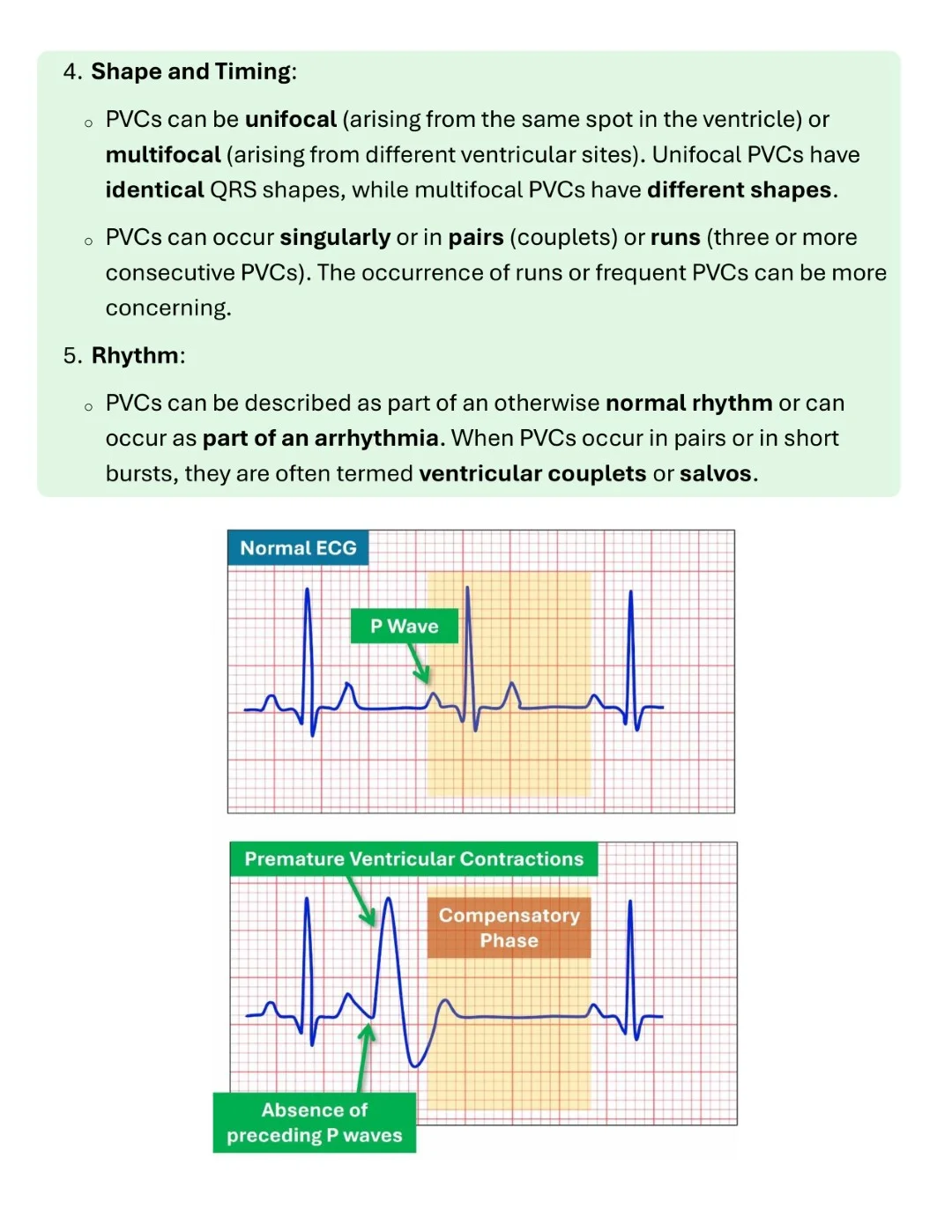 Cambridge ECG Simplified Made Easy Sample images (11)