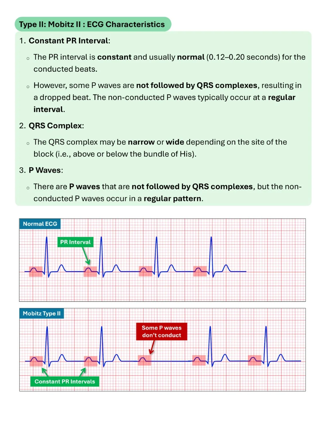Cambridge ECG Simplified Made Easy Sample images (12)