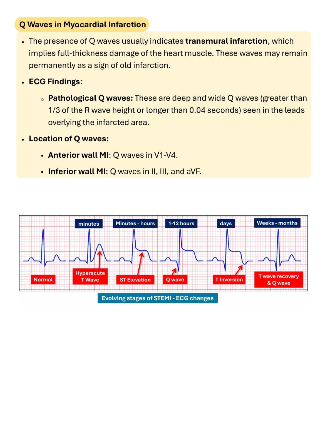 Cambridge ECG Simplified Made Easy Sample images (14)