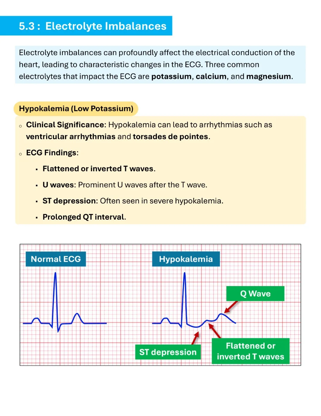 Cambridge ECG Simplified Made Easy Sample images (15)