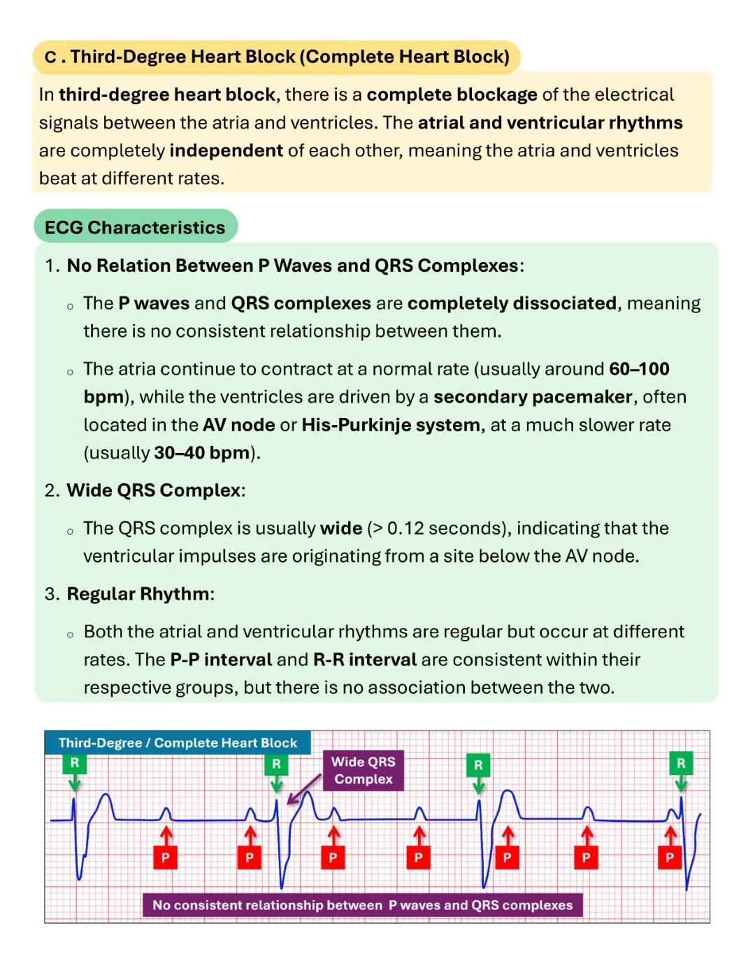 Cambridge ECG Simplified Made Easy Sample images (3)