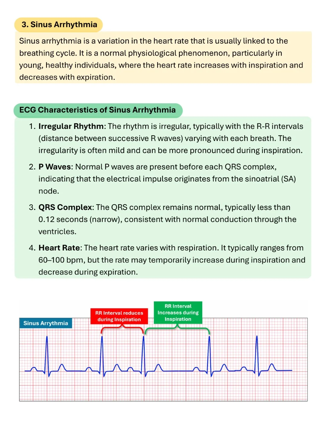 Cambridge ECG Simplified Made Easy Sample images (9)